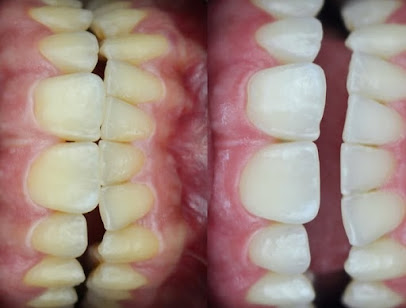 Dra. Carina Udulutsch Soares Odontologia